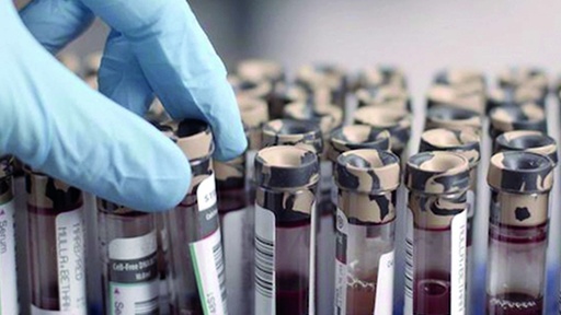 [AR030476-001] Der Bluttest - Welches Kind soll leben?